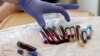 FILE - In this photo taken March 21, 2017, a nurse reaches for blood samples taken from a patient receiving a kind of immunotherapy known as CAR-T cell therapy at the Fred Hutchinson Cancer Research Center in Seattle.